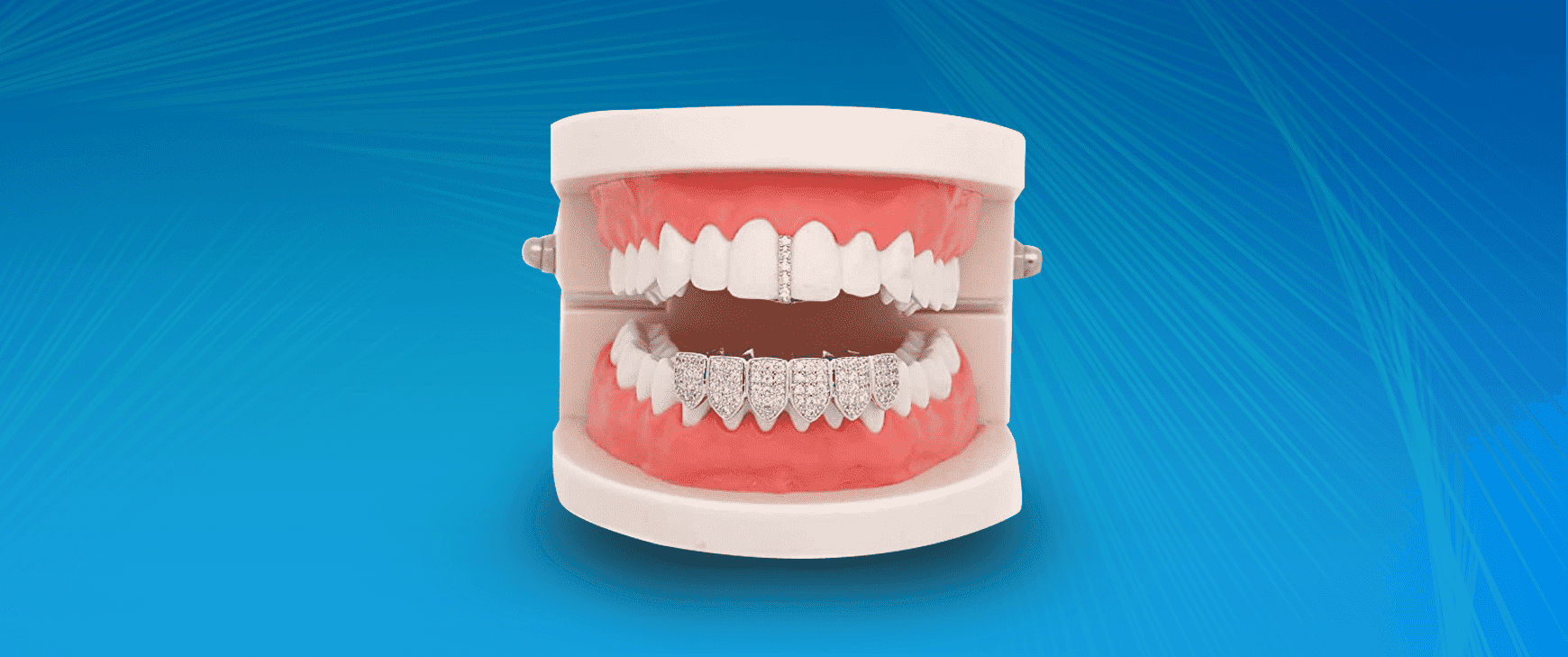 Grillz dentales - Clínica Dental